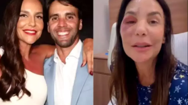 Daniel Cady tranquiliza fãs sobre recuperação de Ivete Sangalo após cirurgia facial