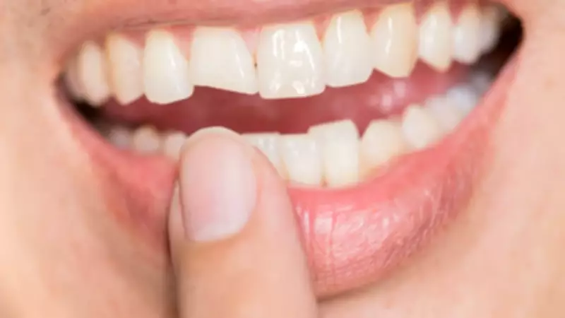 Dente quebrou? Saiba como agir nos primeiros minutos para salvá-lo