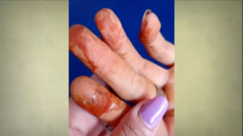 Desafios e Riquezas da Produção Artesanal da Castanha de Caju no RN