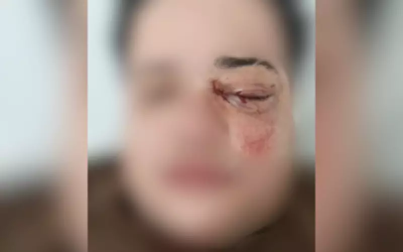Discussão em restaurante termina com duas mulheres agredidas em São José do Rio Preto