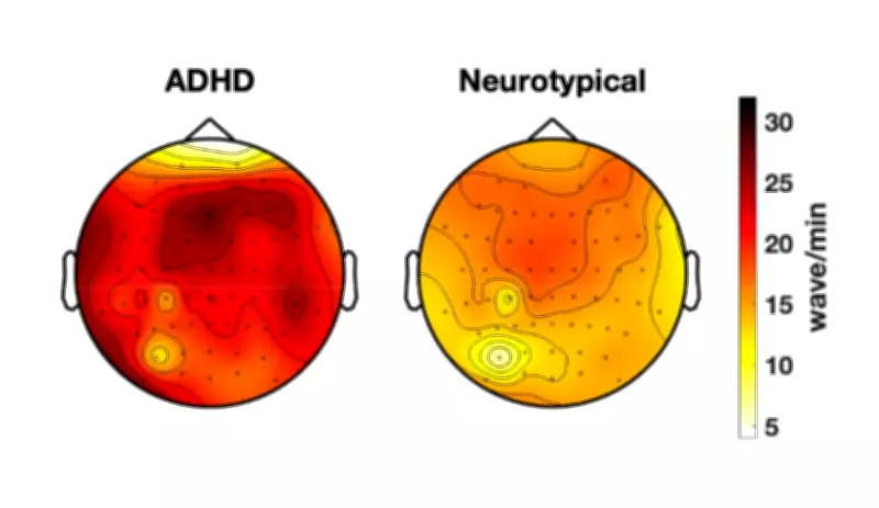 Estudo revela que cérebro de adultos com TDAH tem mais atividade semelhante ao sono durante vigília