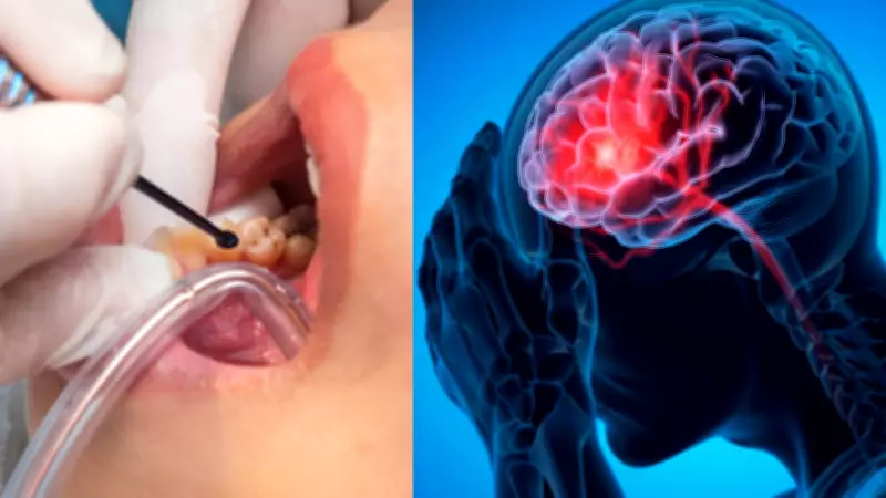 Estudo revela que cáries e doença gengival juntas elevam risco de AVC em 86%