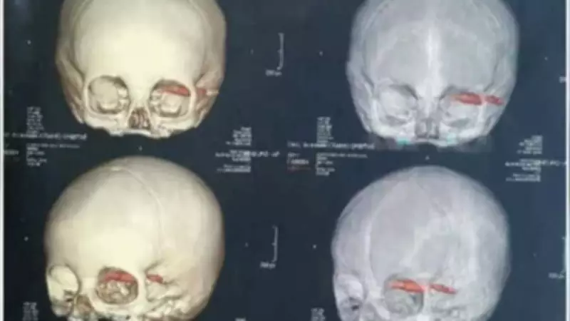 Estudo revela que prática de escurecer dentes no Vietnã é milenar