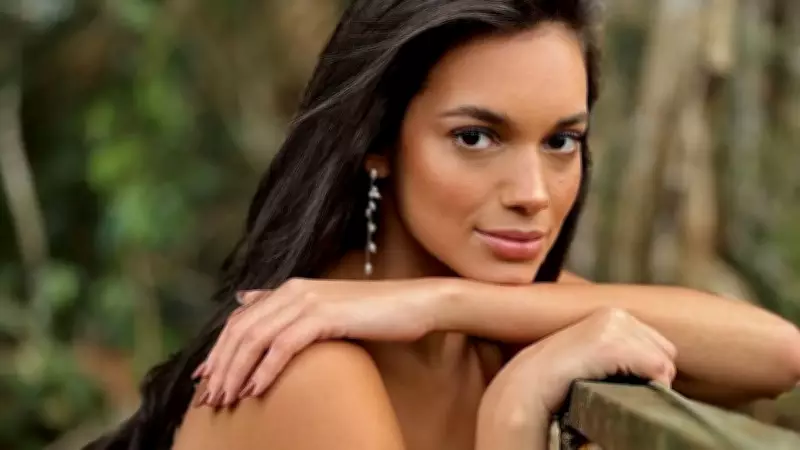 Ex-BBB Alane Dias relata atropelamento por moto no Rio de Janeiro