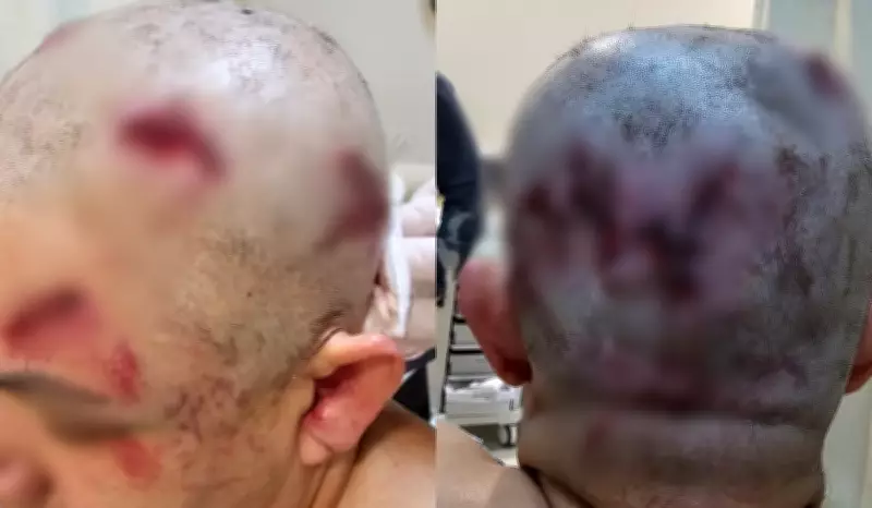 Ex-namorado é julgado por tentativa de feminicídio com marreta em Boituva