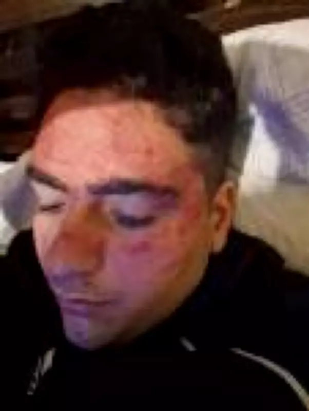 Família brasileira denuncia violência policial contra adolescente autista em Portugal