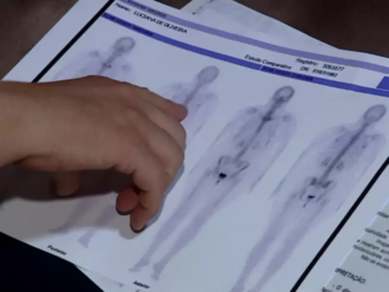 Fibromialgia: Atendimentos crescem 35,4% no SUS de São Paulo e doença é reconhecida como deficiência