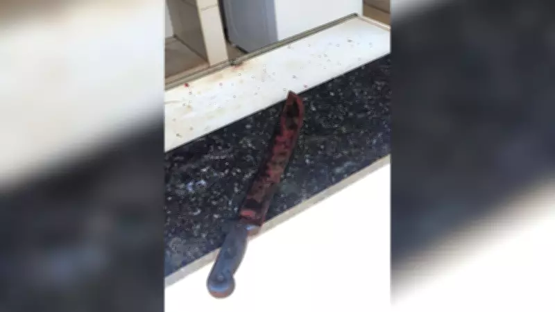 Filho ataca mãe com facão em São José do Rio Preto e vítima tem braço amputado