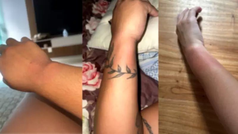 Fãs sofrem queimaduras após uso de pulseiras luminosas em show de Luan Santana em BH