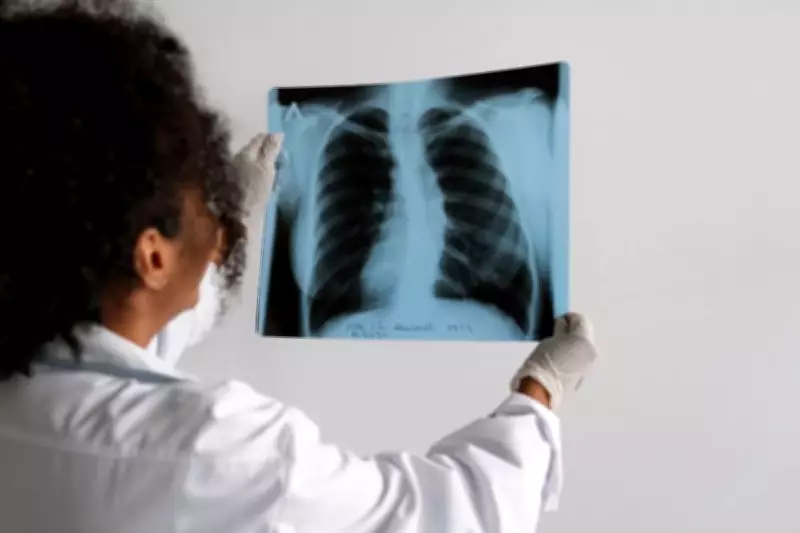 Garça (SP) inicia mutirão para detectar tuberculose em locais públicos e empresas