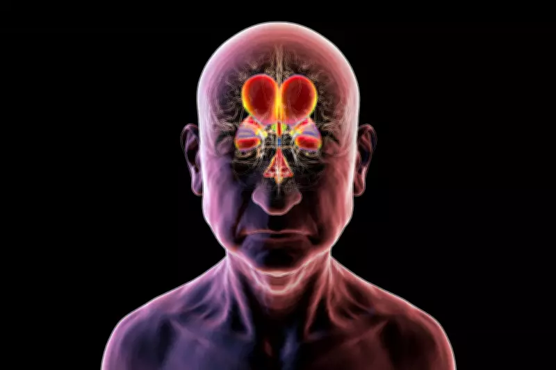 Hidrocefalia de Pressão Normal: Condição Reversível que Pode Ser Confundida com Alzheimer