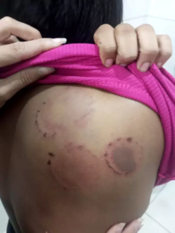 Homem é preso em flagrante após agredir namorada com socos e mordidas em Pinheiro