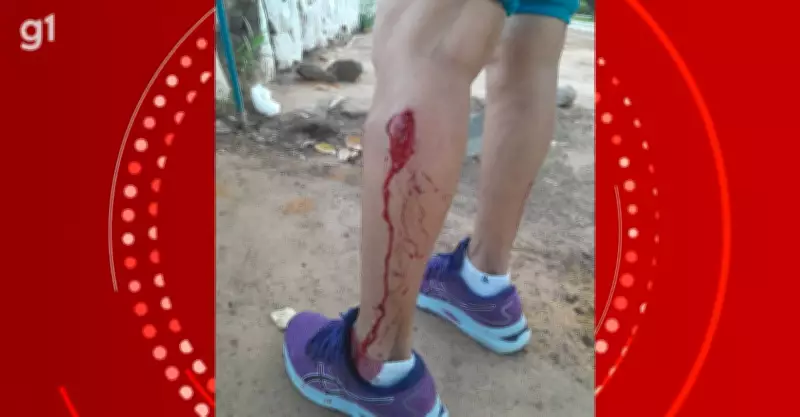 Idosa é atacada por mais de dez cães em parque de Petrolina; ataques preocupam moradores