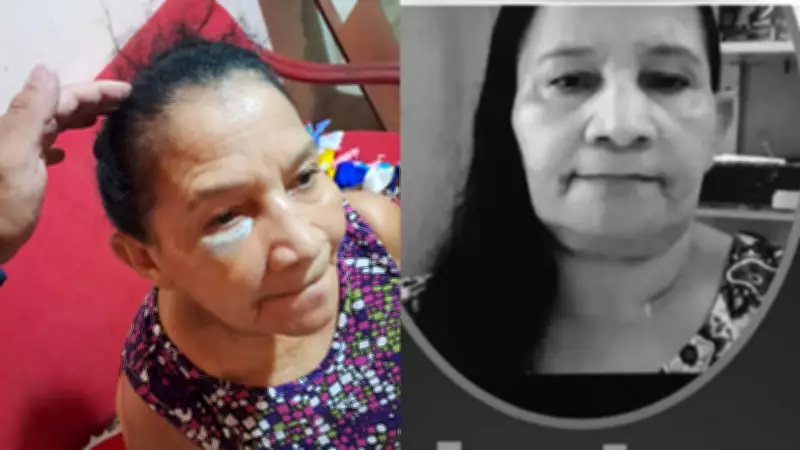 Idosa de 62 anos morre após agressão brutal em São Gonçalo do Piauí