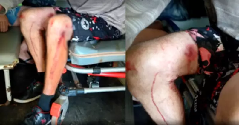 Idoso de 60 anos é atacado por pitbull em Cesário Lange; tutora responderá por crime