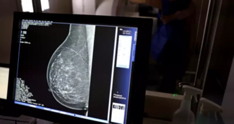 Inteligência Artificial detecta risco cardíaco em mulheres através da mamografia