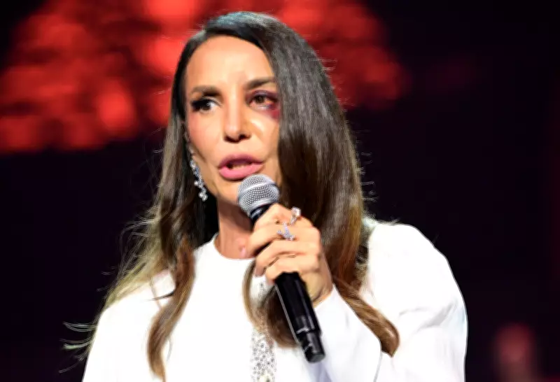Ivete Sangalo revela detalhes de cirurgia facial após queda por síncope vasovagal