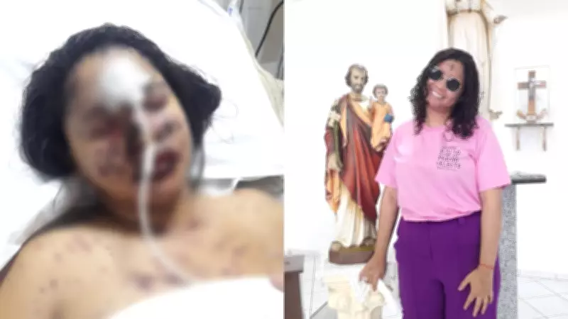 Jovem perde 95% da visão após reação alérgica grave e descobre síndrome rara no Piauí