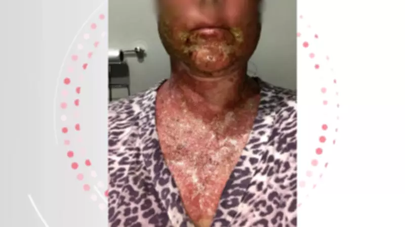 Justiça condena farmacêutico e clínica por queimaduras graves em peeling químico no Paraná