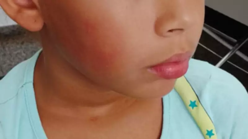 Mãe denuncia monitora por tapa em criança de 8 anos em ônibus escolar em SP