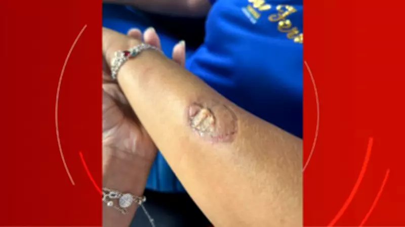 Mãe morde diretora de colégio estadual em Andirá após discussão sobre uniforme escolar