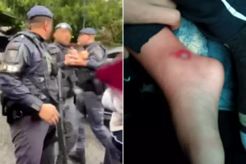 Menino de 3 anos tem pé atropelado por viatura da PM em Santos e policial ameaça família