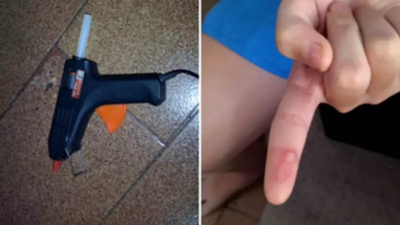 Mães denunciam professora por queimar alunos com cola quente como castigo em escola de Birigui (SP)