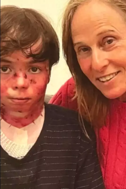 Morre neto de Deborah Colker, que enfrentava doença rara e inspirou espetáculo