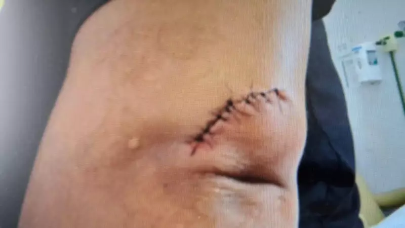 Motorista de aplicativo agride jovem com canivete após discussão sobre porta em Uberaba