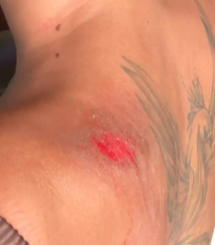 Mulher denuncia perseguição e agressão por mototaxista após desvio de rota em Maceió