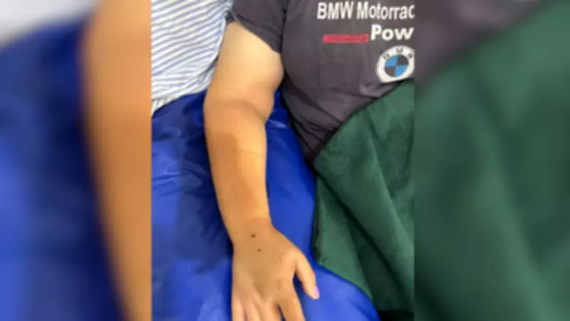 Mulher é picada por jararaca durante colheita de abóboras em sítio de Dirce Reis (SP)