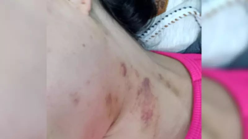 Mulher tem tímpano perfurado após agressão do ex-companheiro em Itapetininga (SP)