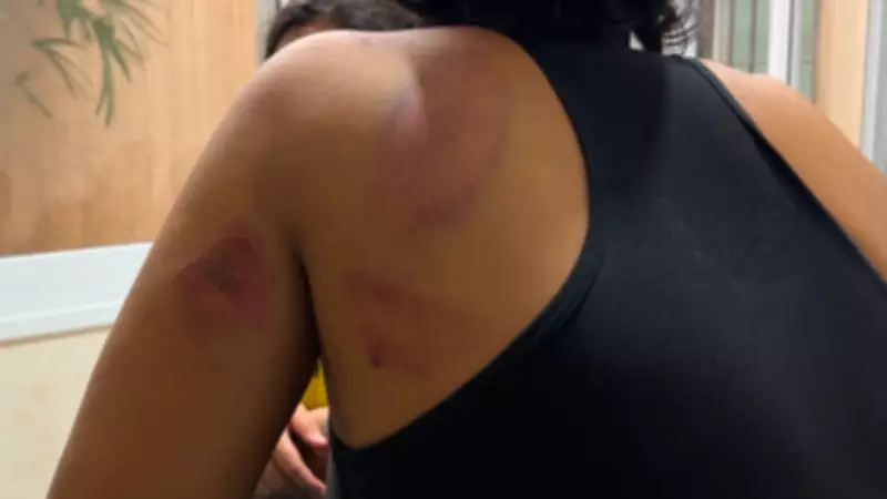 Mulheres são torturadas por dívida de R$ 100 em drogas em São José do Rio Preto