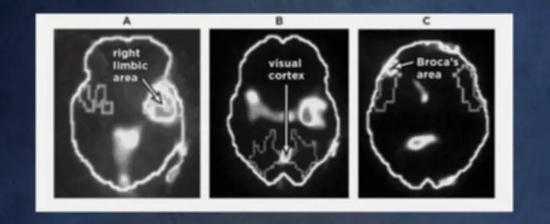 Neurocientista explica como violência altera o cérebro de mulheres vítimas de abuso