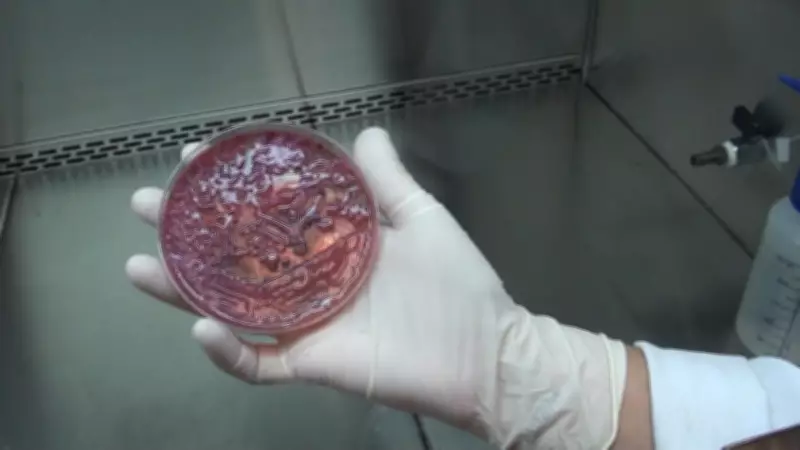 Novo caso de superbactéria KPC é identificado em enfermaria do Hospital Mário Gatti em Campinas