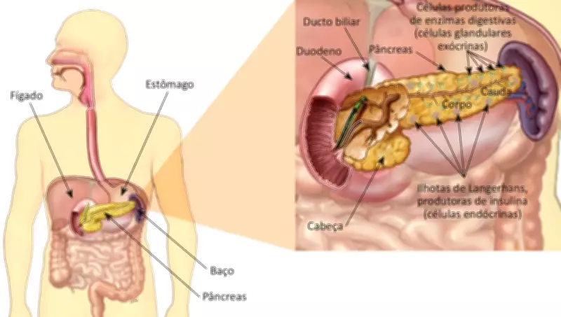 Pancreatite no Vale do Paraíba: Mortes Suspeitas Ligadas a Canetas Emagrecedoras