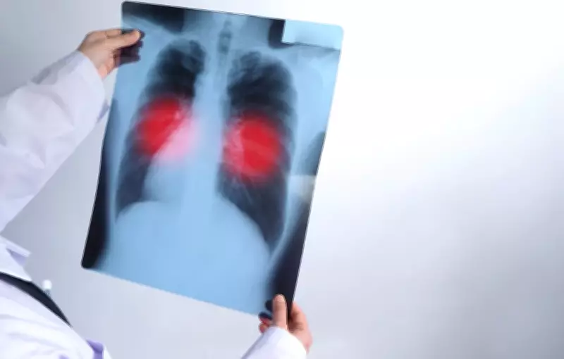 Paraíba registra aumento de 14% nos casos de tuberculose em 2025, com 1.581 notificações