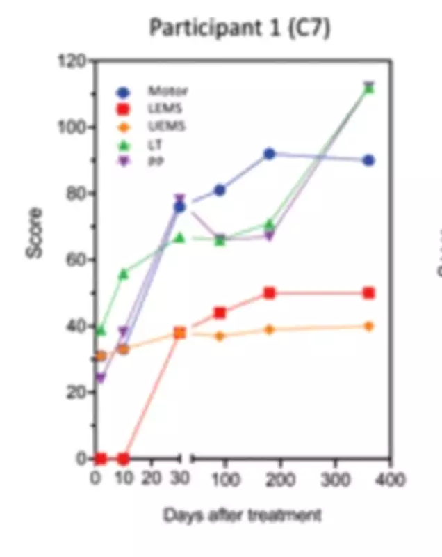 Polilaminina: revistas científicas recusam estudo por divergências em dados e falta de registro