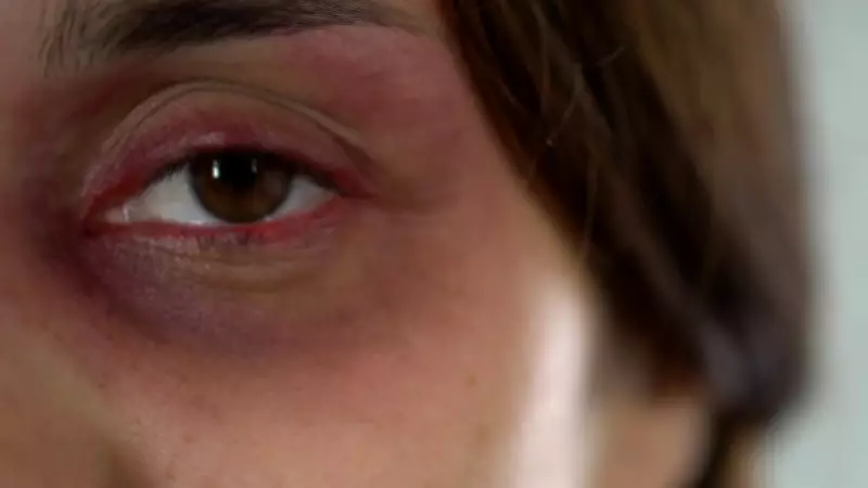 Projeto nacional capacita mulheres para combater violência de gênero com curso gratuito