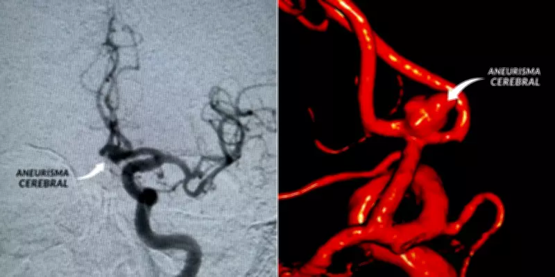 Sambista mineira Adriana Araújo sofre aneurisma cerebral e está em coma em BH