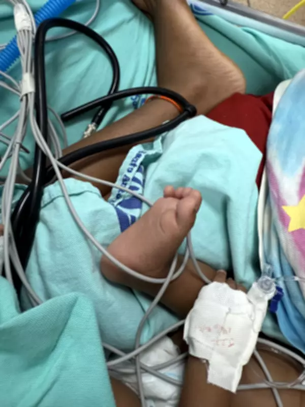 Surto de coqueluche na Terra Yanomami: divergências sobre mortes e vacinação