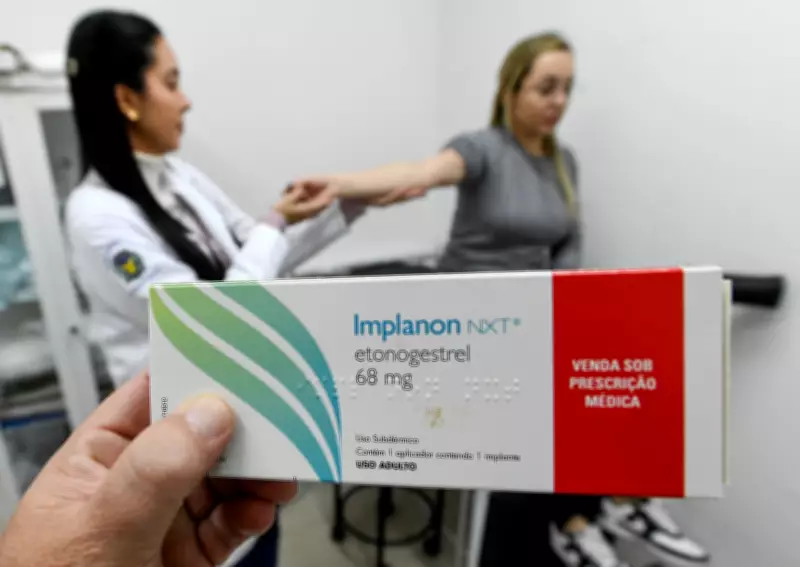 SUS amplia acesso a implante contraceptivo de longa duração no oeste do Pará