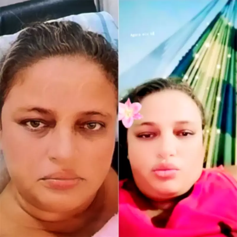 Terceira morte de paciente renal após interdição de clínica de hemodiálise em Mossoró