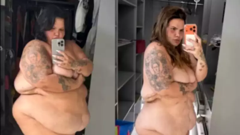 Thais Carla Perde 8 Quilos em 15 Dias Após Cirurgia Bariátrica e Acompanhamento Médico