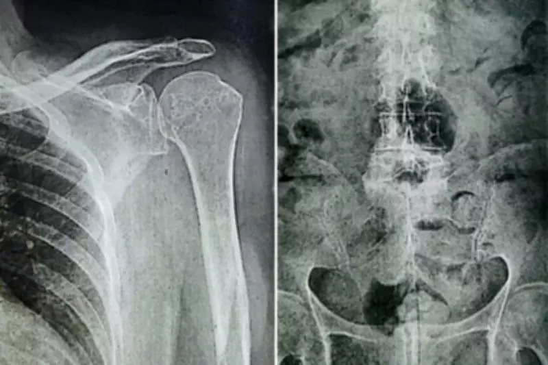 TJ-SP condena Assaí Atacadista a indenizar idosa que escorregou em poça de detergente