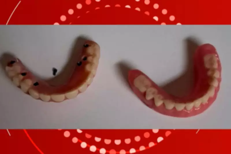 TJMT condena clínica odontológica a devolver R$ 13,8 mil por prótese defeituosa em Cuiabá