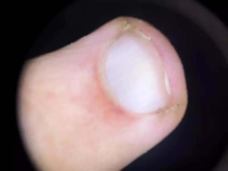 Unhas e circulação: especialistas explicam quando alterações indicam problemas de saúde