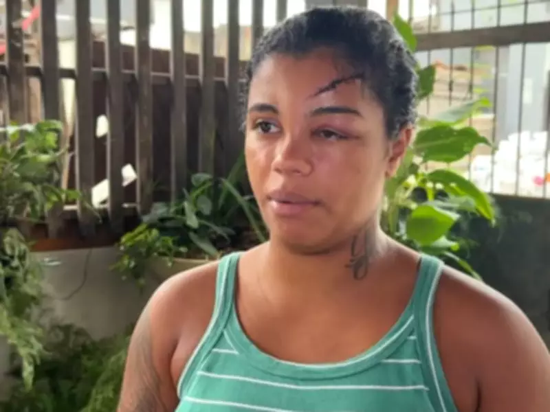 Vítima de tentativa de feminicídio em Praia Grande relata agressões brutais do ex-marido