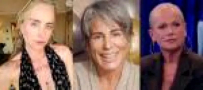 Xuxa e Angélica adotam 'gerenciamento do envelhecimento': nova abordagem na medicina estética