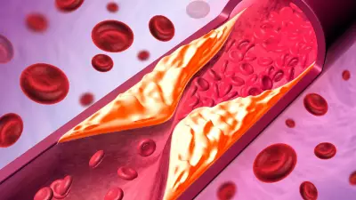 Cereais açucarados no café da manhã ameaçam saúde do coração, alertam cardiologistas